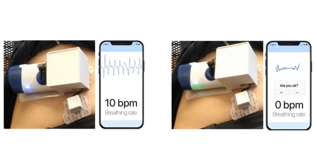 Showing the prototype wearable injector before injection (left) whilst a participant is breathing normally and during injection (right). Once a participant simulated an apnea event, comparable to an opioid overdose, the device automatically injects naloxone.